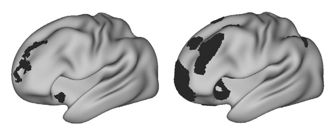 A brain network associated with attention is larger in people with depression